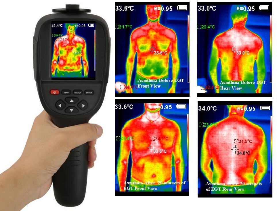 Thermal Imaging Camera used for measuring the body’s Infrared energy emission